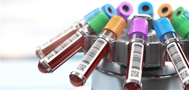 Plasmakarussell. Brauchbare Probengewinnung ist auch eine Zeitfrage.