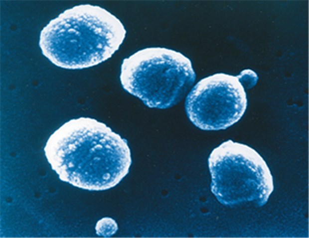 England: Impfen senkt Rate von Pneumonien deutlich Pneumokokken: Die Keime sind die häufigsten Verursacher bakterieller Pneumonien.