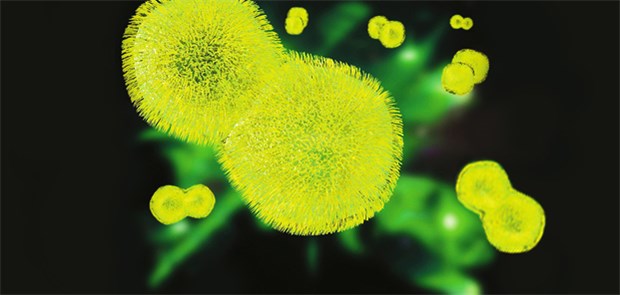 Sepsis - verkappte Todesursache Nummer eins Pneumokokken sind die häufigsten Erreger für Pneumonien in Deutschland. Viele Pneumonien-Patienten sterben letztendlich an einer Sepsis.
