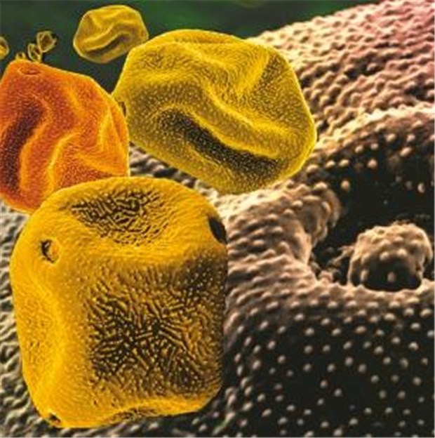 Höchste Zeit fürs Impfen gegen Birken- und Graspollen Pollen im Elektronenmikroskop. Sie sind häufiger Auslöser von Allergien.