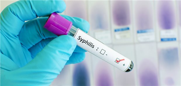 Positiv auf Syphilis getestet: Mit Blick auf Syphilisinfektionen unterscheidet sich die Situation in Deutschland nicht grundsätzlich von jener in den USA.
