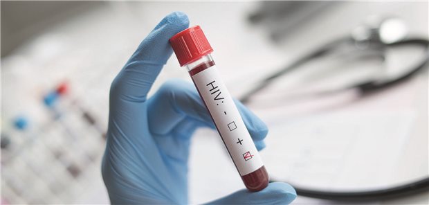Ein positiver HIV-Test (Symbolbild mit Fotomodell)