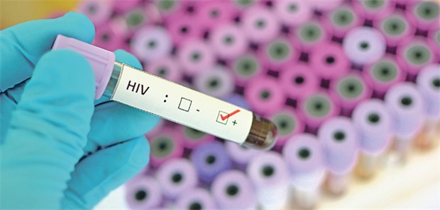 Viel zu viele Vorurteile – selbst im Gesundheitswesen Positiver HIV-Test: Nicht immer wird in der Praxis mit dem Ergebnis diskret umgegangen.