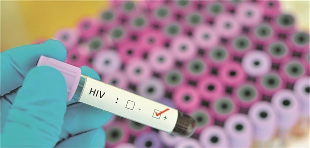 Ärzte können aus dem Vollen schöpfen Positiver HIV-Test. Vor Therapiebeginn wird ein HIV-Genotyp-Resistenztest empfohlen.