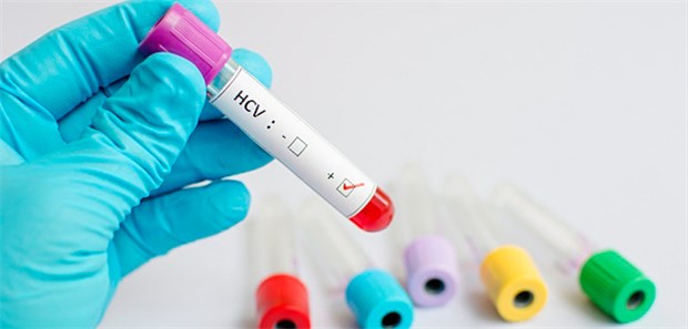 Positiver Hepatitis-C-Test: In Deutschland leben immer noch viele Menschen mit einer nicht entdeckten chronischen Hepatitis.