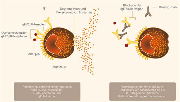 Potenzieller Wirkmechanismus von Omalizumab: Omalizumab blockiert die Bindung von IgE an Mastzellen und führt dadurch zu einer Reduktion der FCRI-Rezeptoren. Somit wird die Histaminfreisetzung unterbunden.