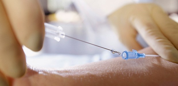 Potenzielles Einfallstor für S. aureus: Venenverweilkatheter.