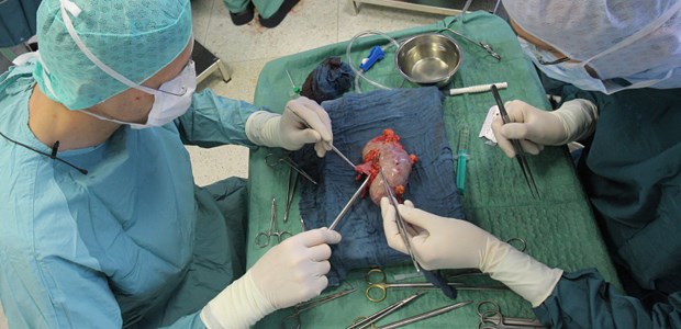 Wie eine Behörde die Transplantationsmedizin retten soll Präparation einer Niere, die auf ihren neuen Empfänger wartet: Wo geht die Reise für die deutsche Transplantationsmedizin hin?
