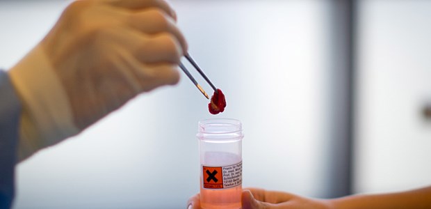 Mit Vollgas ins BGB Praeputium nach Zirkumzision: Jetzt soll die Vorhaut ins Gesetz, was nicht ohne Kritik bleibt.