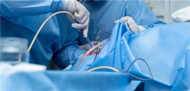 Präzisionsarbeit im OP. Nicht weniger präzise muss hinterher die Abrechnung sein, zum Beispiel wenn es darum geht, ob zusätzlich zur Zielleistung (hier: Adenotonsillektomie) weitere Leistungen abgerechnet werden können oder nicht.