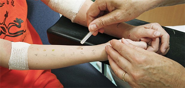 Allergien machen Kindern zu schaffen Prick-Test: Allergische Erkrankungen wie Neurodermitis gehören weiterhin zu den häufigsten gesundheitlichen Beeinträchtigungen bei Heranwachsenden