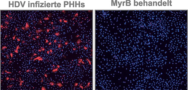 Neue Arzneimittelklasse gegen Hepatitis B und D in Sicht Primäre humane Hepatozyten (PHH) in Kultur: Bei der Behandlung mit Myrcludex B (rechts) werden sie nicht mit Hepatitis-D-Viren (rot) befallen.