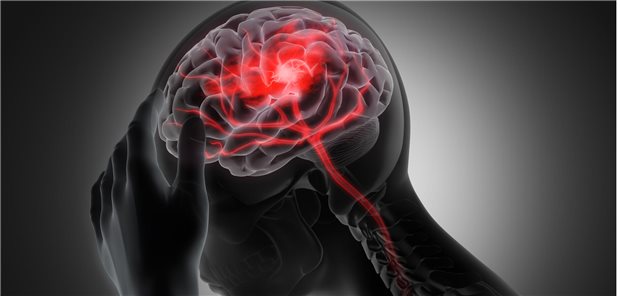 Primärer Endpunkt war der Anteil von Patienten ohne große funktionelle Beeinträchtigungen 90 Tagen nach dem Schlaganfall (mRS = 0–1). Dieses Ziel erreichten 64,4 Prozent mit der Sublingualtherapie, aber nur 54,7 Prozent unter Placebo. Die absolute Differenz von 9,7 Prozentpunkten erwies sich als statistisch signifikant.