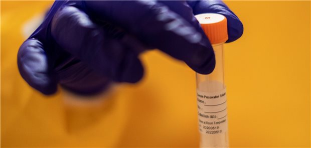 Positiv-Rate bei PCR-Tests steigt auf 3,7 Prozent Probe nach dem Abstrich: PCR-Test vor der Analyse im Labor.