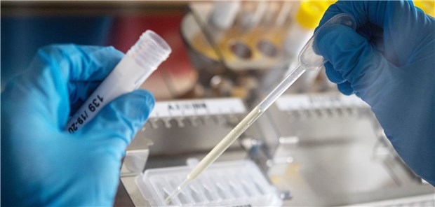 Labortest auf SARS-CoV-2 liegt ab sofort im Ermessen der Ärzte Proben für die Labordiagnostik: Auf SARS-CoV-2 können Ärzte jetzt bei sehr viel mehr Personen testen lassen.-