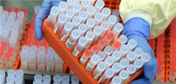 Facharztlabore üben scharfe Kritik an Abwertung der PCR-Tests im EBM Proben von SARS-CoV-2-PCR-Tests in einem Labor-MVZ in Leipzig: Die Fachlabore analysieren derzeit rund eine Million PCR-Tests auf SARS-CoV-2 pro Woche.