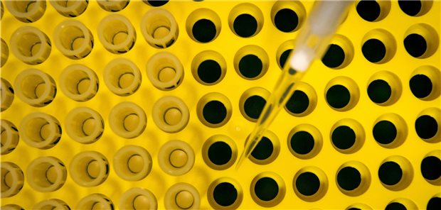 Preis eines Krebsmedikaments am Wert orientieren anstatt an den Kosten Probenabfüllung im Labor: Die Entwicklung neuer Onkologika ist in der Regel teuer und zeitaufwändig.