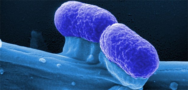 Harmlose Bakterien im Kampf gegen Krebs Probiotische E.-coli-Bakterien unter dem Elektronenmikroskop.