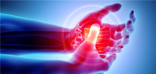 Probleme mit den Händen? Nicht selten steht dann eine längere Tour durch diverse Fachpraxen bevor.