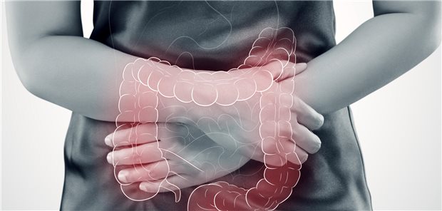 Problemfeld Dickdarm: Von der chronisch-entzündlichen Erkrankung Colitis ulcerosa sind in Deutschland etwa 400.000 Menschen betroffen.