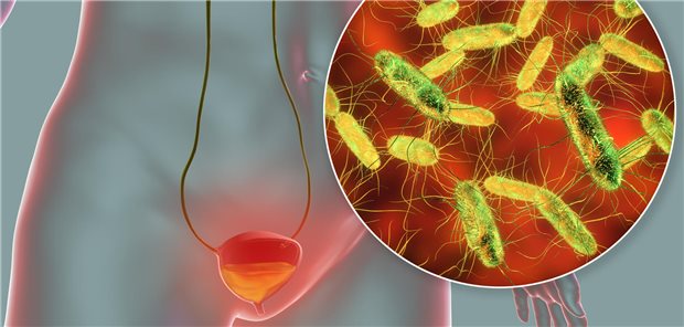 Prof. Florian Wagenlehner, Urologe an der Justus-Liebig-Universität Gießen und Leitlinienautor der S3-Leitlinie zur unkomplizierten Harnwegsinfektion, gibt an, dass eine nichtantibiotische Therapie als Alternative zur antibiotischen Behandlung erwogen werden kann, da wie Studien gezeigt haben, bei ungefähr zwei Drittel der Patientinnen auf Antibiotika verzichtet werden könne.
