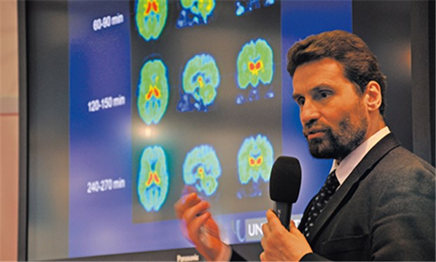 Froschgift-Derivat spürt Alzheimer früh auf Professor Osama Sabri zeigt erste Bilder mit einem neuen PET-Marker.