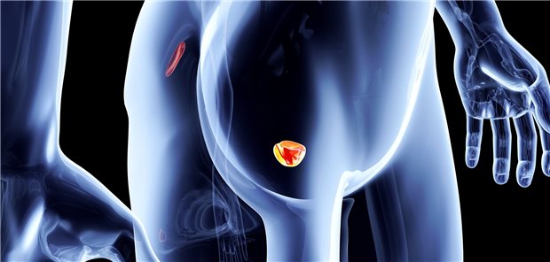 Prostata-Krebs: Männer, die öfter als drei Mal in neun Monaten eine PSA-Wert-Messung vornehmen lassen, bekommen mehr Biopsien und mehr Krebsdiagnosen.
