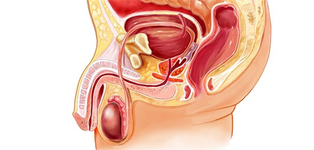 Prostatabiopsie unter Ultraschallsicht: Nach Bestrahlung eines Prostata-Ca ist das Risiko für Blasen-, Kolorektal- und Rektum-Ca erhöht.