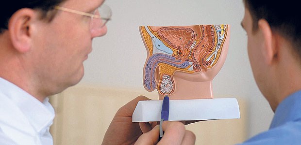 Bundesweite Studie erfolgreich gestartet Prostatakrebs ist die häufigste Krebsart bei Männern in Deutschland.