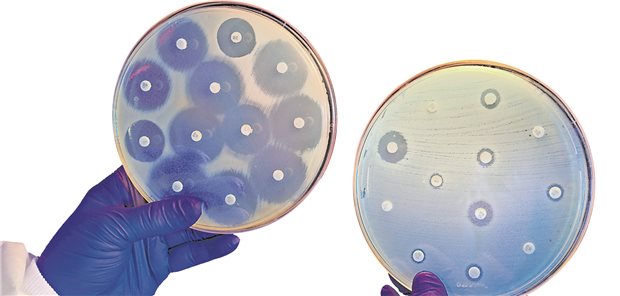 Prüfung auf Resistenzen: Der Blick sollte sich nicht nur auf die Wirksamkeit und Unwirksamkeit von Antibiotika beschränken. 