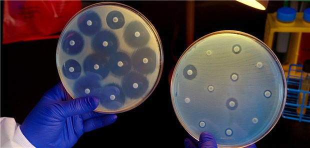 „Jede Antibiotikatherapie führt zu Resistenzen“ Prüfung auf Resistenzen: Solche Tests sind für Strategien zum Umgang mit Antibiotika unentbehrlich.