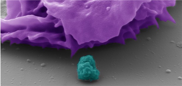 Katz-und-Maus-Spiel ums Immunsystem Pseudokolorierte elektronenmikroskopische Aufnahme einer menschlichen Fresszelle (lila) und eines Bakteriums (türkis). Mit Hilfe des untersuchten Rezeptors CEACAM3 ist die Fresszelle in der Lage, die etwa einen Mikrometer großen Bakte rien zu erkennen und zu vernichten. Electron Microscopy Centre
