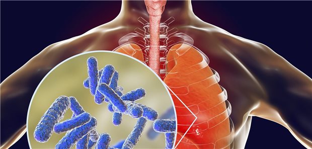 Pseudomonas aeruginosa in der Lunge