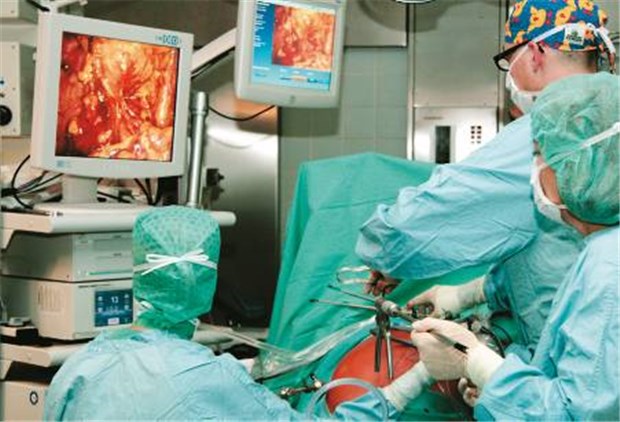 World of medicine (W.O.M.) Pumpen von W.O.M. im Einsatz bei einer Schlüsselloch-Op.