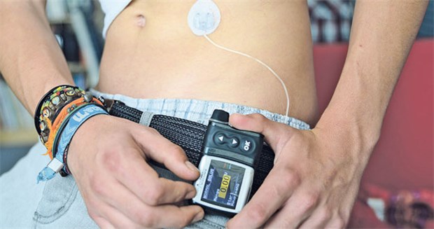 'Die Insulinpumpe verlängert das Überleben' Pumpentherapie ahmt die physiologische Insulinversorgung genauer nach als konventionelle Therapie.