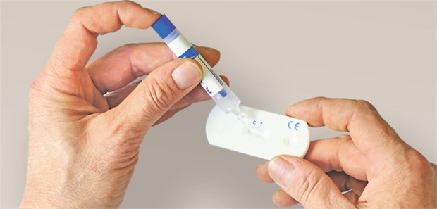 Qualitativer immunologischer Stuhltest: Nach Beschluss des GBA keine Option für die Regelversorgung.