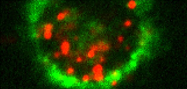Impfen ohne Injektion Querschnitt einer Langerhans-Zelle (Membran in grün). Aufgenommene Nanopartikel sind rot dargestellt. Langerhans Zellforschung Labor, Medizinische Universität Innsbruck