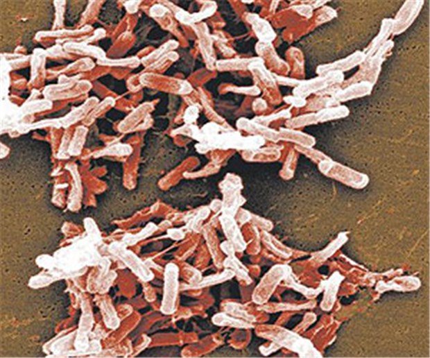 Clostridium difficile wird gefährlicher REM einer Kolonie mit Clostridium difficile.