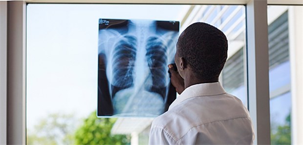 Mit Asthma-Arznei schwerer Pneumonie vorbeugen? Radiologische Lungendiagnostik: Bei einer Influenza-Pneumonie kann die Sterblichkeitsrate bis zu 40 Prozent betragen.