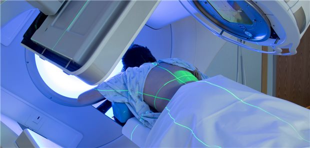 Radiotherapie: Hinweise auf eine raschere und intensivere Schmerzlinderung bei Wirbelmetastasen durch stereotaktische Radiochirurgie (SRS) im Vergleich zur konventionellen externen Radiotherapie (CRT) ließen sich in einer Studie nicht bestätigen.&#xA;