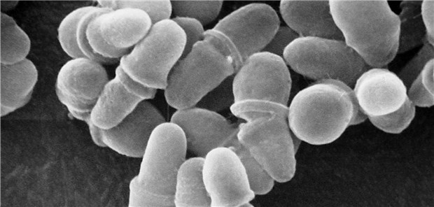 Rasterelektronenmikroskopie-Aufnahme von Sporen des Pilzes Malassezia spp.