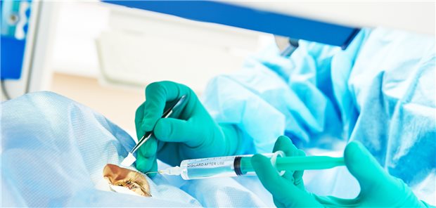 Spritze und Skalpel am offenen Auge unter einem Laser