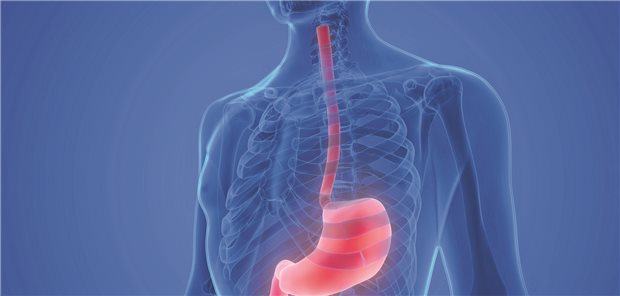 Relevante Zufallsbefunde bei der ösophagogastroduodenalen Kontrollendoskopie sind bei Personen mit Vorhofflimmern nach einer HPSD-Ablation nicht selten, das geht aus einer Analyse aus Oldenburg hervor.