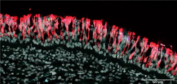 Respiratorisches Epithel eines COVID-19-Patienten, der viereinhalb Tage nach der Diagnose an der Infektion starb, mit der SARS-CoV-2 Variante Omikron BA.2. Die rote Farbe steht für die Anfärbung mit einem Antikörper gegen das Nukleokapsid-Protein des Virus. Die grünen und blauen Punkte sind virale RNA-Moleküle, die nur während der Vermehrung des Erregers vorhanden sind. Nahezu jede Zelle des Epithels diente zum Zeitpunkt der Entnahme der Gewebeprobe als „Fabrik“ für die Bildung viraler RNA.