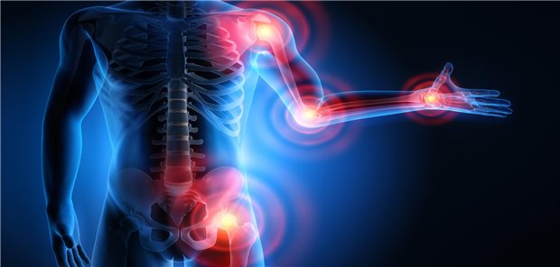 Rheuma-Schmerzpunkte: Europas Rheumatologen setzen bei der künftigen Präzisionsmedizin, aber auch in der Frühdiagnostik auf den Einsatz Künstlicher Intelligenz.
