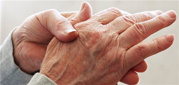 Appell an Ärzte, Daten zu COVID-19 und Rheuma zu liefern Rheuma und COVID-19: Um Erkenntnisse zu gewinnen, werden Patientendaten von Rheumatologen benötigt. Evrymmnt / stock.adobe.com