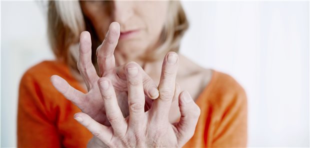 Rheumapatientin: Mitunter kann die immunsuppressive Therapie die Impfantwort beeinträchtigen. Vor Behandlungsbeginn sollte daher der Impfstatus geprüft werden.