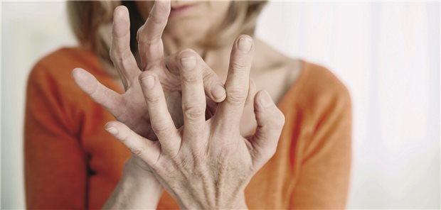 Frau mittleren Alters mir Rheuma hält ihre Finger in die Kamera.