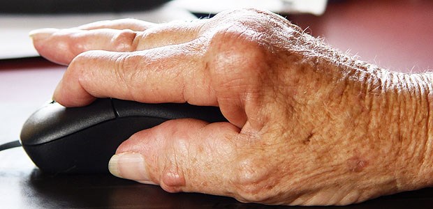 Rheuma-Patienten leben zehn Jahre länger Rheumatoide Arthritis lässt sich immer besser behandeln. Die Zahl der Patienten, die trotz der Erkrankung arbeiten können, ist in den vergangenen Jahren deutlich gestiegen.