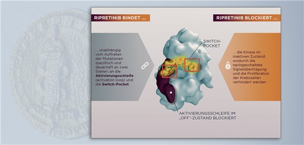 Ripretinib inhibiert mit seiner dualen Wirkweise nicht nur die Wildtypform, sondern auch primäre und sekundäre Mutationen der Kinasen KIT und PDGFRA.&#xA;